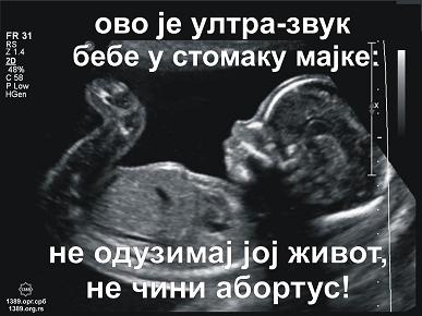 Ultra zvuk plakat 5 jpg